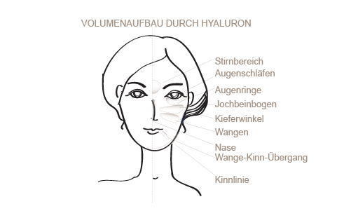 Faltenunterspritzung Mit Hyaluron In Nurnberg Behandlung Kosten